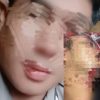 Diduga Aniaya Warga Pakai Sajam, Oknum Anggota Polres Melawi Dilaporkan ke Propam